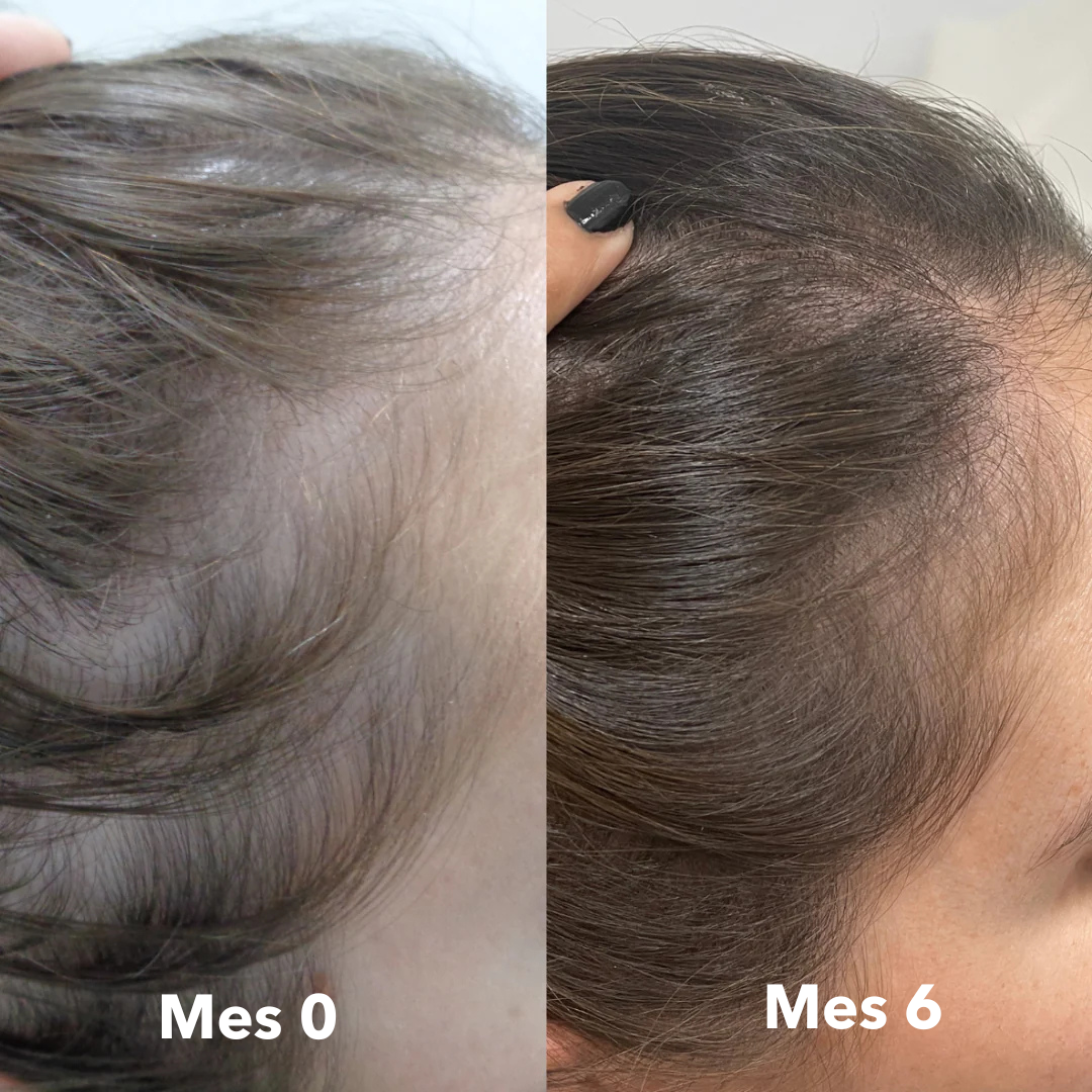 Dúo Anticaída | Shampoo & Acondicionador en Barra